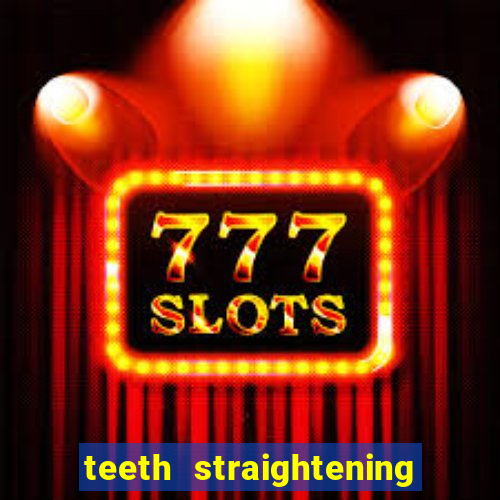 teeth straightening los altos