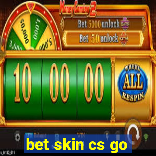 bet skin cs go