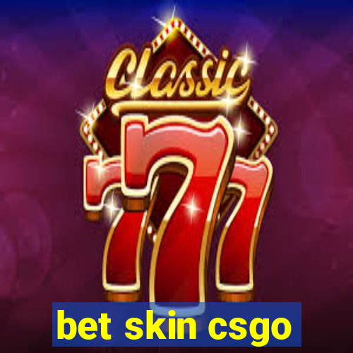 bet skin csgo