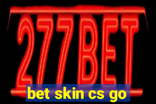 bet skin cs go