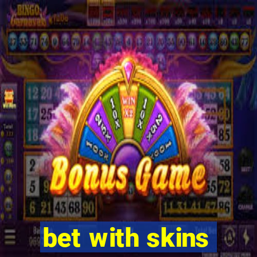 bet with skins