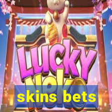 skins bets